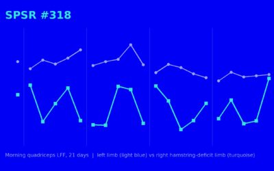 Inter-limb low-frequency fatigue tracks the distribution of training dose rather than the underlying deficit: a case report from a five-week strength camp in an elite youth footballer